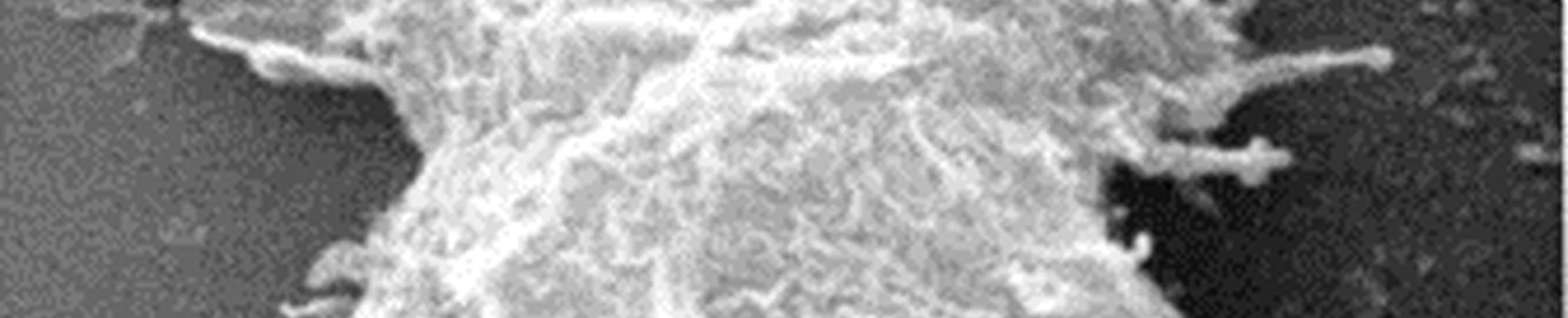 Acanthamoeba, voire pire