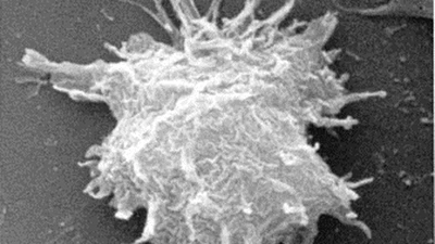 Acanthamoeba, voire pire featured image