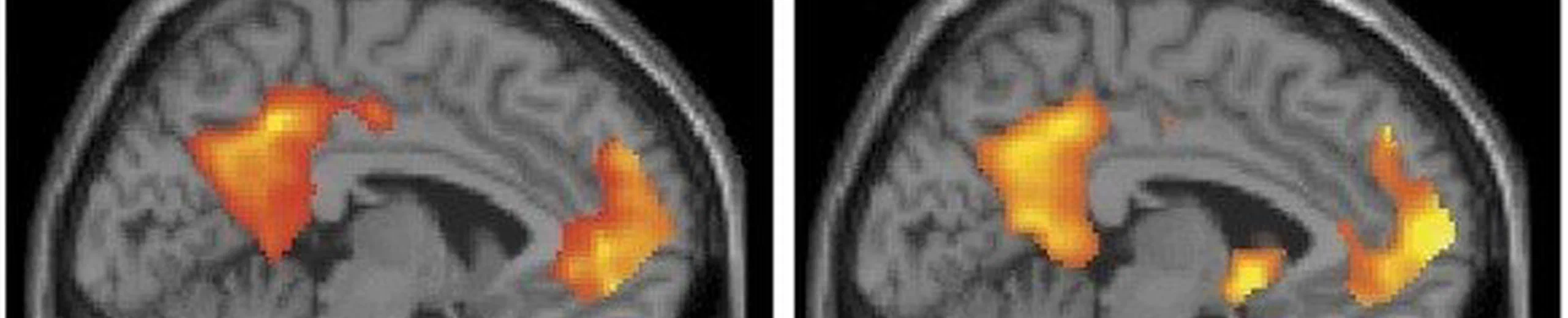 D'un point de vue athée, qu'est-ce qui fait que notre conscience soit liée à notre cerveau spécifiquement ?