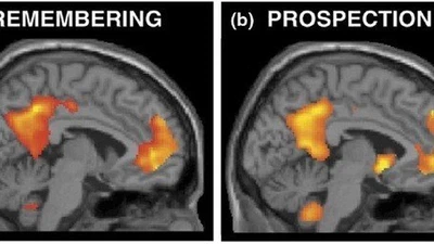 D'un point de vue athée, qu'est-ce qui fait que notre conscience soit liée à notre cerveau spécifiquement ? featured image